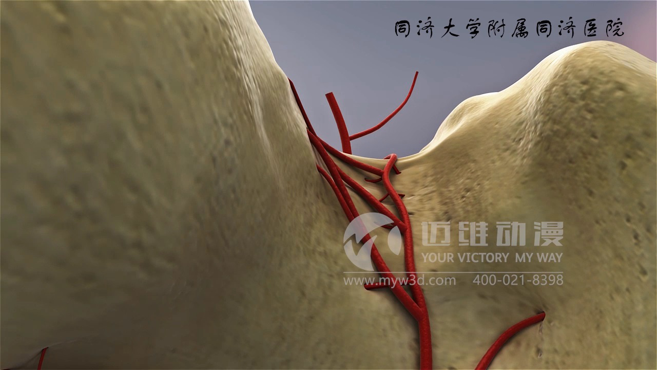 醫(yī)學(xué)仿真三維動(dòng)畫演示 醫(yī)學(xué)仿真三維動(dòng)畫演示