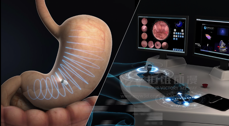 醫(yī)用設備三維動畫制作好處有哪些？(圖3)