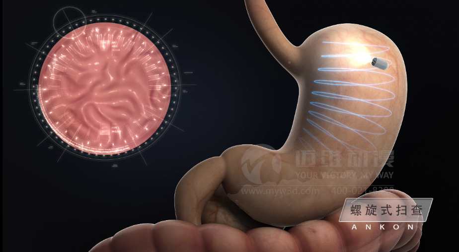 醫(yī)用設備三維動畫制作好處有哪些？(圖2)