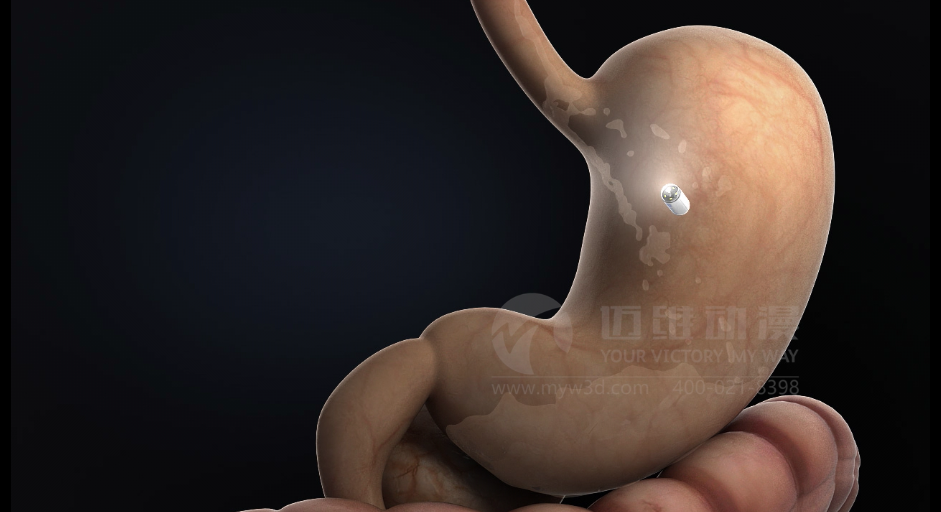 醫(yī)用設備三維動畫制作好處有哪些？(圖1)