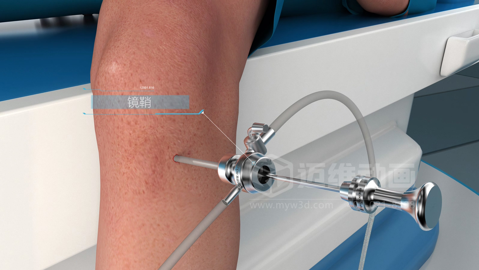 醫(yī)學(xué)手術(shù)三維動(dòng)畫(huà)制作公司哪家好？解碼上海邁維動(dòng)漫的醫(yī)學(xué)醫(yī)療3D可視化創(chuàng)新之路(圖2)